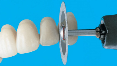 D+Z小编告诉你如何有效的使用牙科车针